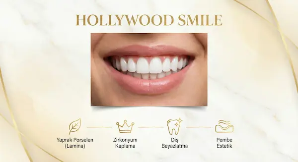 Hollywood Smile